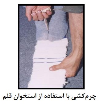 توضیح عکس